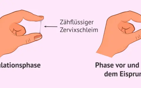 Hände zeigen Zervixschleim: zähflüssig in der Ovulationsphase, klumpig vor und nach dem Eisprung. Ein Einblick in den weiblichen Zyklus.
