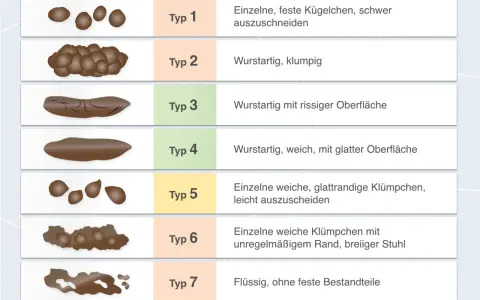 Stuhlformen von Typ 1 (hart, klumpig) bis Typ 7 (flüssig). Bei keinem Stuhlgang ab wann bedenklich? Die Grafik zeigt verschiedene Stuhltypen.