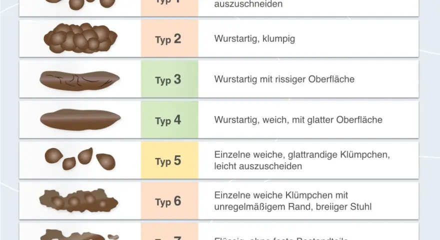 Stuhlformen von Typ 1 (hart, klumpig) bis Typ 7 (flüssig). Bei keinem Stuhlgang ab wann bedenklich? Die Grafik zeigt verschiedene Stuhltypen.