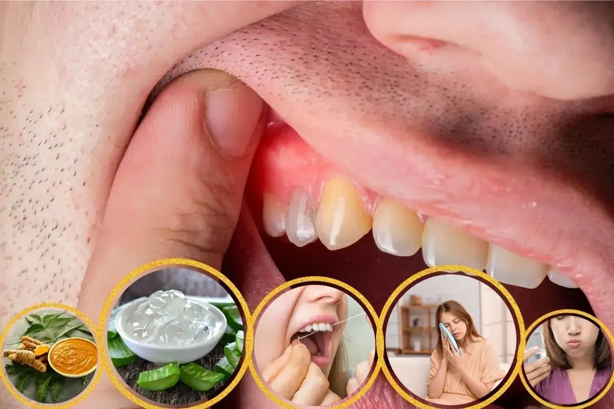 Zahnfleischschmerzen? Bild zeigt entz&uuml;ndetes Zahnfleisch, Aloe Vera, Kurkuma, Zahnseide, eine Frau mit Schmerz und Mundsp&uuml;lung.